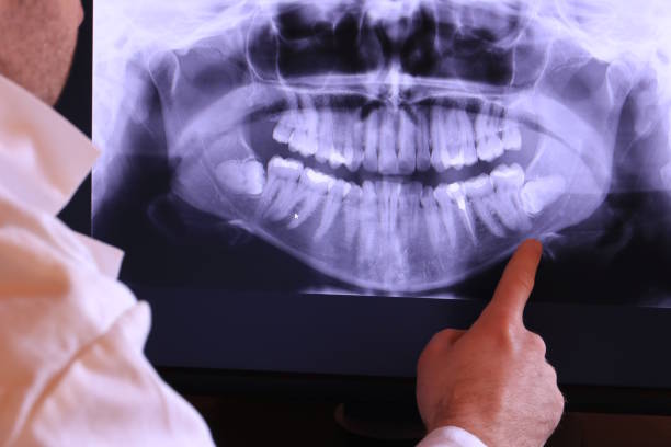 Best Mobile Emergency Dentist in Walnut Grove, GA