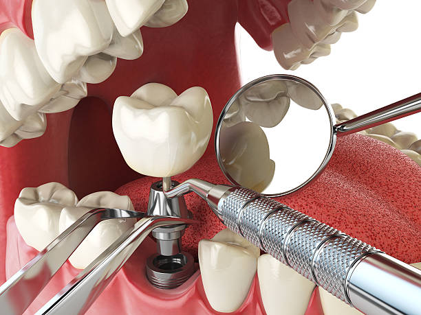 Best Weekend Emergency Dentist in Walnut Grove, GA
