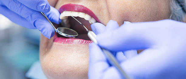 Best Emergency Dentist for Lost Fillings or Crowns in Walnut Grove, GA